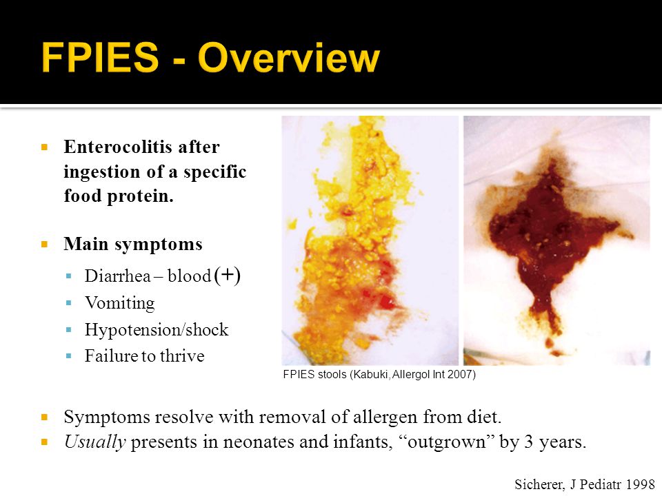 Bloody diarrhea Vomiting Failure to thrive Cow's Milk Soy Hypotension  Shock. - ppt download
