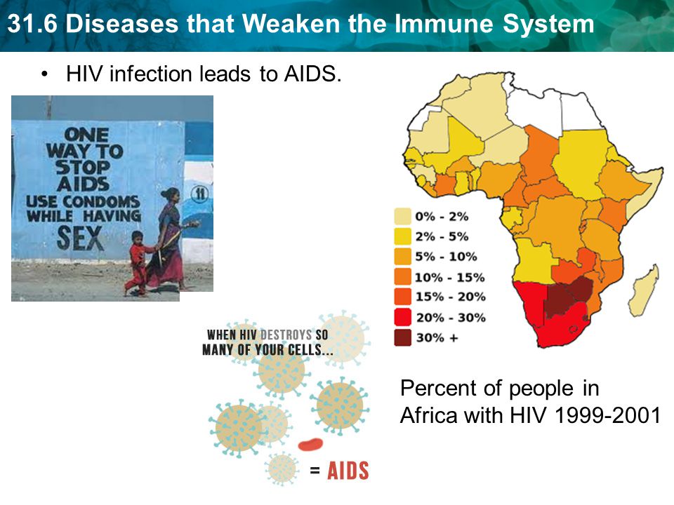 31.6 Diseases that Weaken the Immune System HIV infection leads to AIDS.