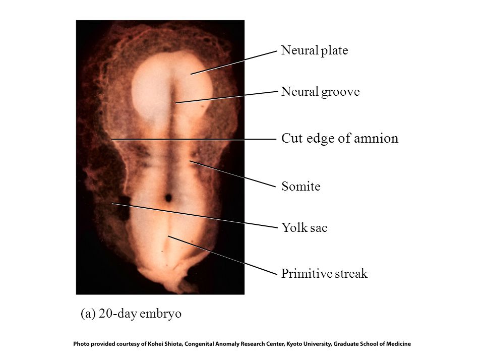 Neural plate (a) 20-day embryo Neural groove Cut edge of amnion Somite Yolk sac Primitive streak