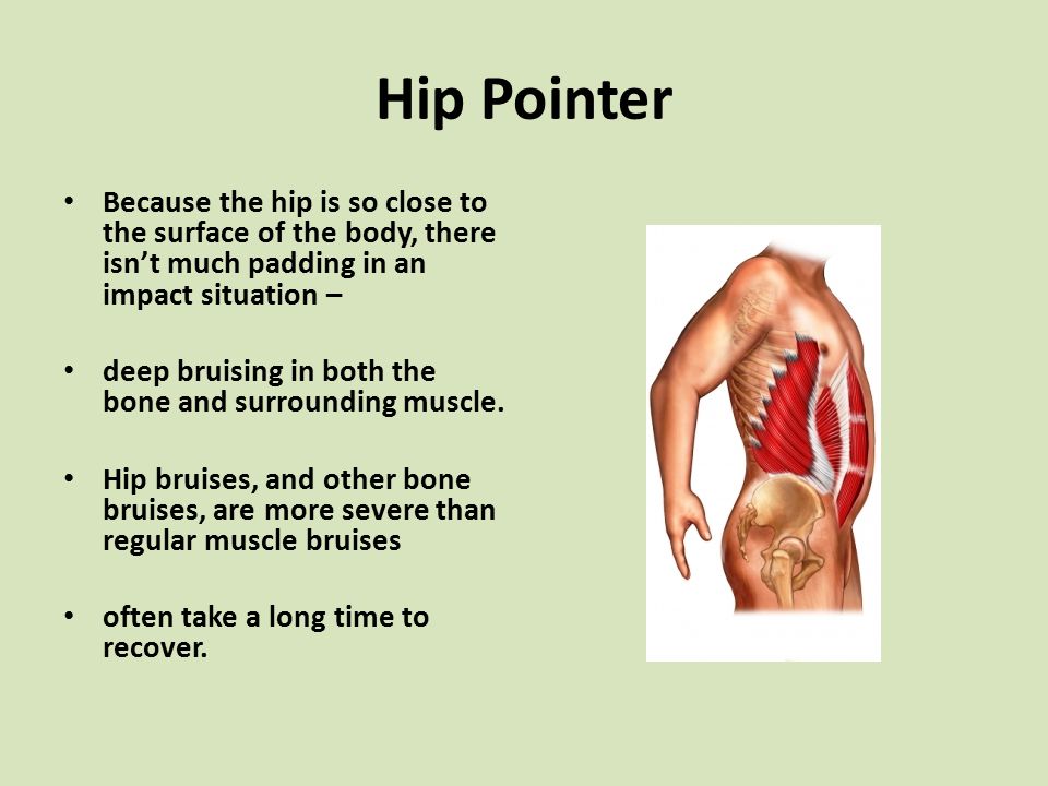 What is this?. Name of the lecture today Hip Pointer A hip pointer