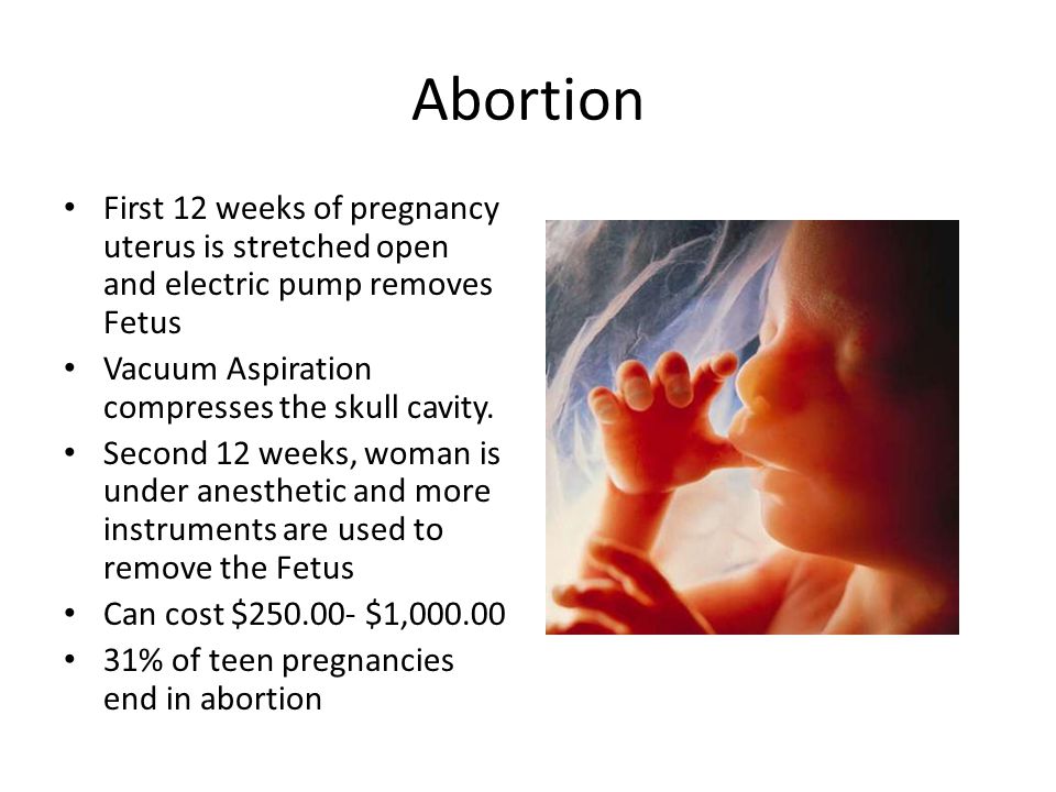 Abortion First 12 weeks of pregnancy uterus is stretched open and electric pump removes Fetus Vacuum Aspiration compresses the skull cavity.
