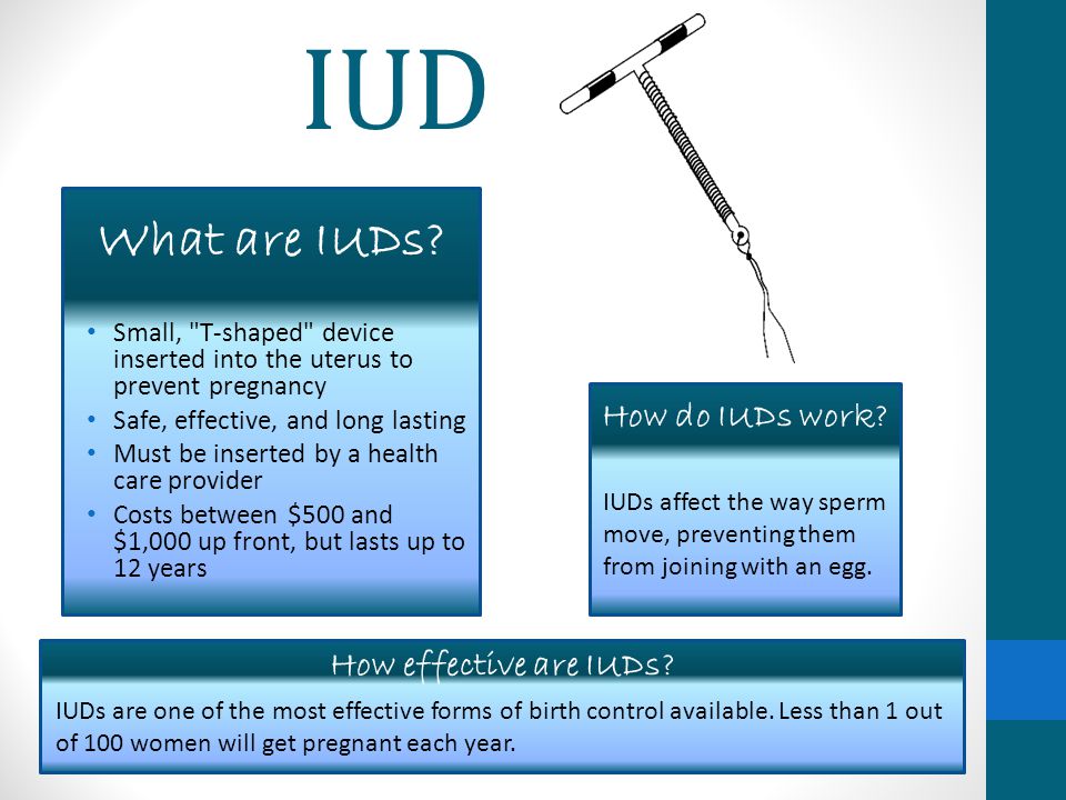IUD Small, T-shaped device inserted into the uterus to prevent pregnancy Safe, effective, and long lasting Must be inserted by a health care provider Costs between $500 and $1,000 up front, but lasts up to 12 years IUDs affect the way sperm move, preventing them from joining with an egg.