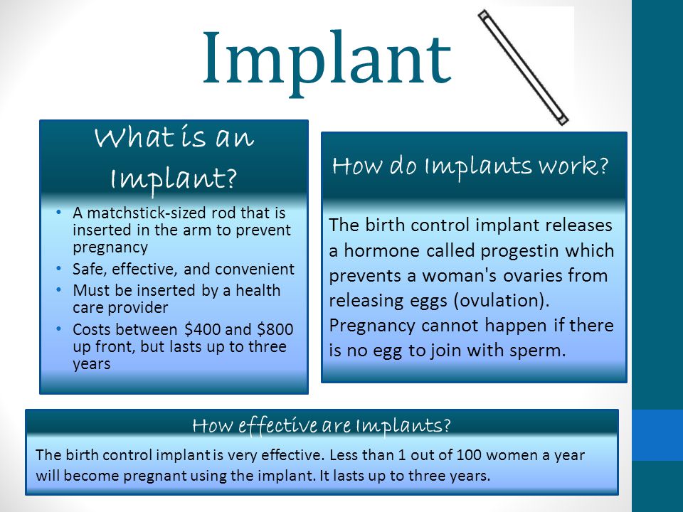 Implant A matchstick-sized rod that is inserted in the arm to prevent pregnancy Safe, effective, and convenient Must be inserted by a health care provider Costs between $400 and $800 up front, but lasts up to three years The birth control implant releases a hormone called progestin which prevents a woman s ovaries from releasing eggs (ovulation).