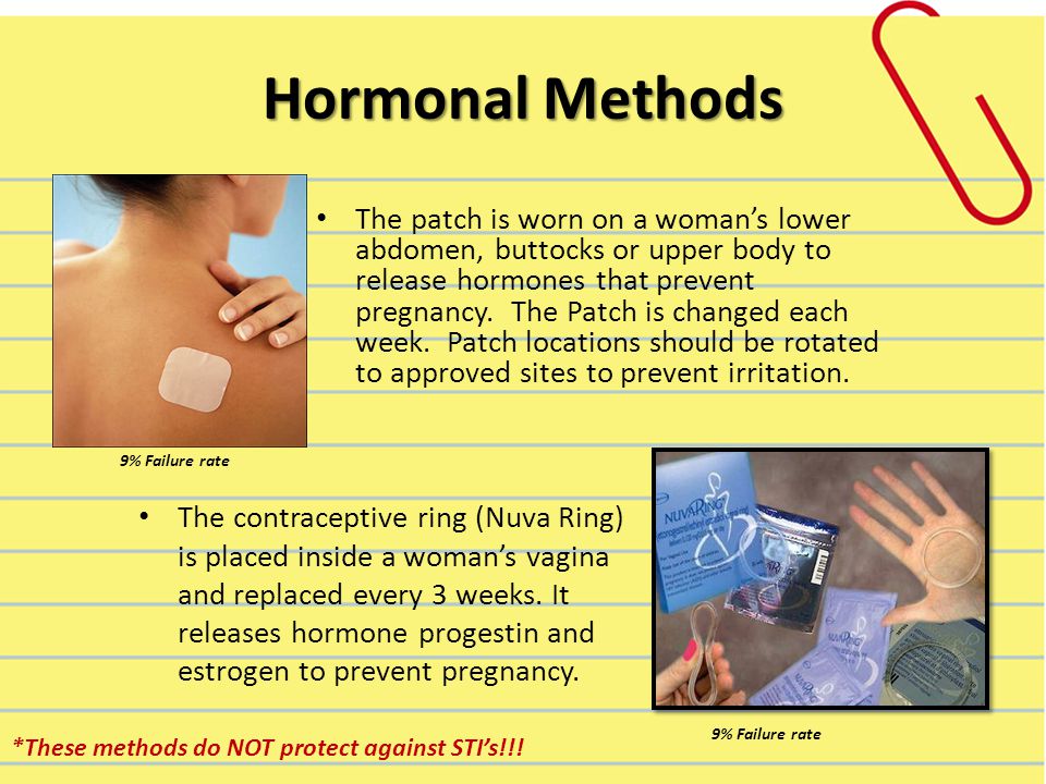Hormonal Methods The patch is worn on a woman’s lower abdomen, buttocks or upper body to release hormones that prevent pregnancy.