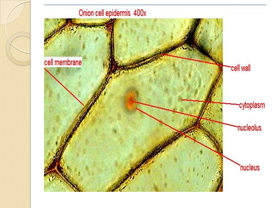 Onion Cells Labeled Vacuole