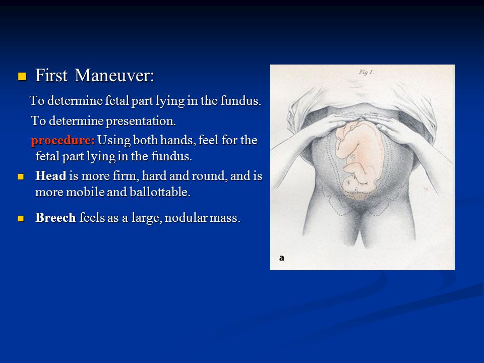 First Maneuver: First Maneuver: To determine fetal part lying in the fundus.