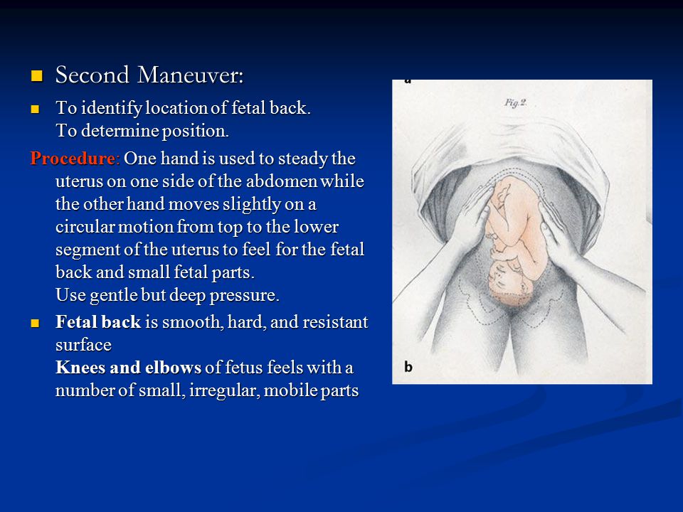 Second Maneuver: Second Maneuver: To identify location of fetal back.
