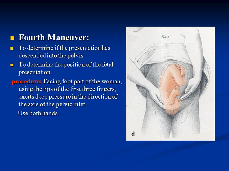 Fourth Maneuver: Fourth Maneuver: To determine if the presentation has descended into the pelvis To determine if the presentation has descended into the pelvis To determine the position of the fetal presentation To determine the position of the fetal presentation procedure: Facing foot part of the woman, using the tips of the first three fingers, exerts deep pressure in the direction of the axis of the pelvic inlet procedure: Facing foot part of the woman, using the tips of the first three fingers, exerts deep pressure in the direction of the axis of the pelvic inlet Use both hands.