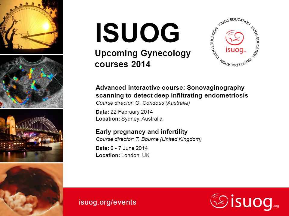 ISUOG Upcoming Gynecology courses 2014 Advanced interactive course: Sonovaginography scanning to detect deep infiltrating endometriosis Course director: G.