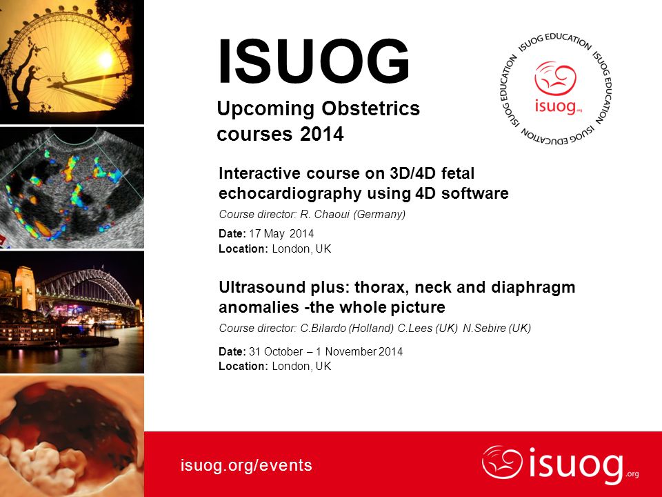 ISUOG Upcoming Obstetrics courses 2014 Interactive course on 3D/4D fetal echocardiography using 4D software Course director: R.