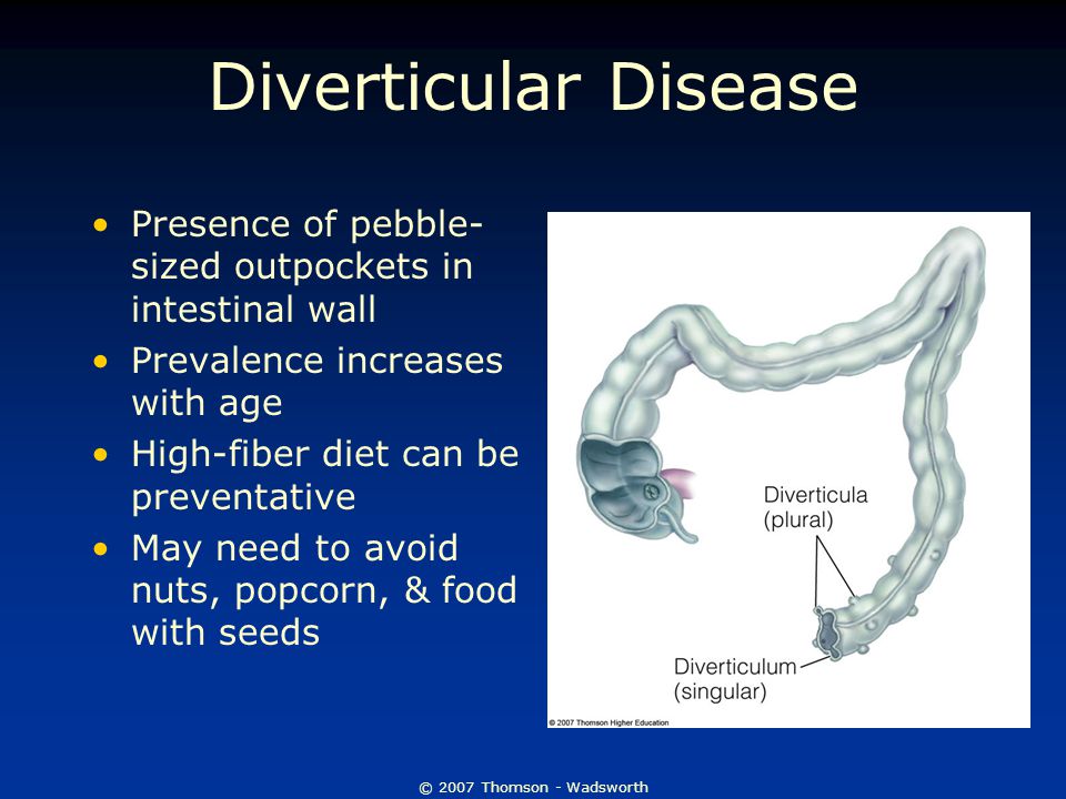 © 2007 Thomson - Wadsworth Diverticular Disease Presence of pebble- sized outpockets in intestinal wall Prevalence increases with age High-fiber diet can be preventative May need to avoid nuts, popcorn, & food with seeds