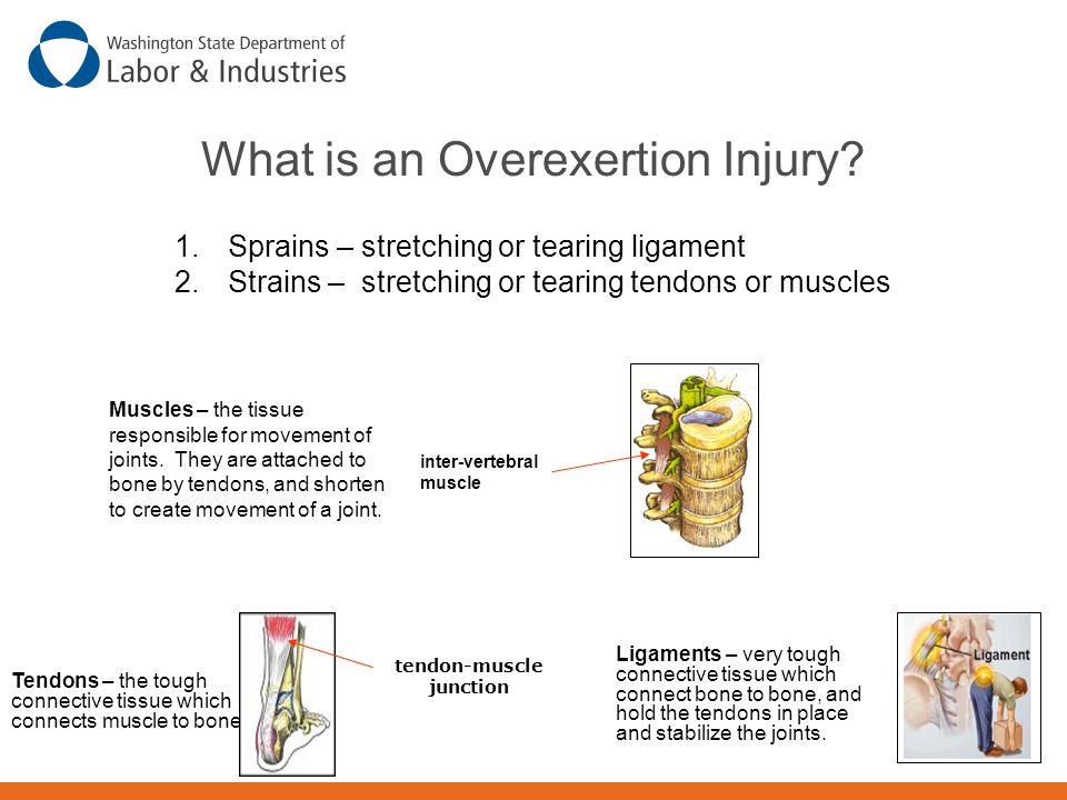What is an Overexertion Injury.