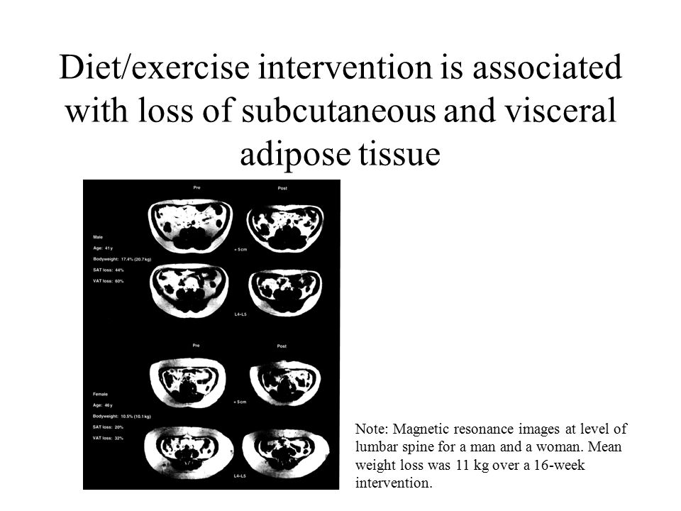 Diet/exercise intervention is associated with loss of subcutaneous and visceral adipose tissue Note: Magnetic resonance images at level of lumbar spine for a man and a woman.