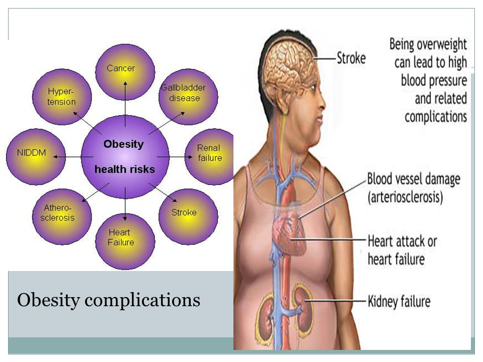 Obesity complications