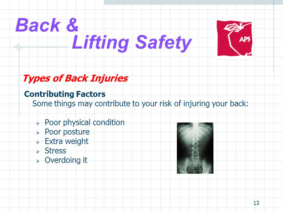 13 Back & Lifting Safety Types of Back Injuries Contributing Factors Some things may contribute to your risk of injuring your back:  Poor physical condition  Poor posture  Extra weight  Stress  Overdoing it
