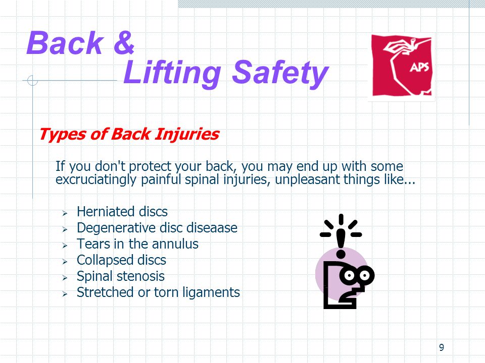 9 Back & Lifting Safety Types of Back Injuries If you don t protect your back, you may end up with some excruciatingly painful spinal injuries, unpleasant things like...