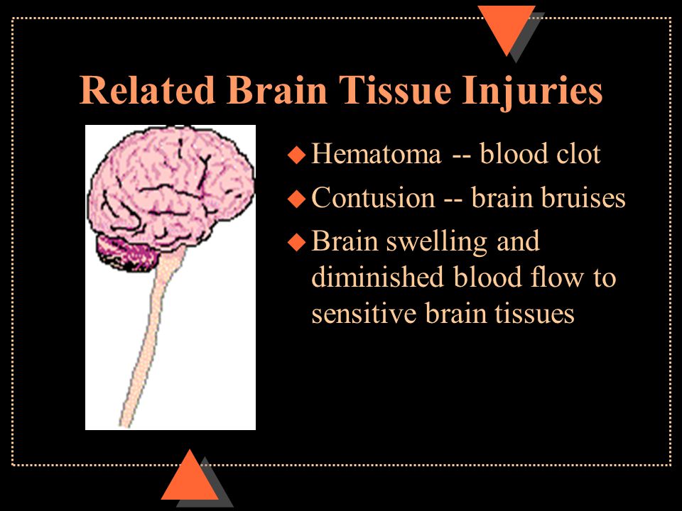 Related Brain Tissue Injuries u Hematoma -- blood clot u Contusion -- brain bruises u Brain swelling and diminished blood flow to sensitive brain tissues