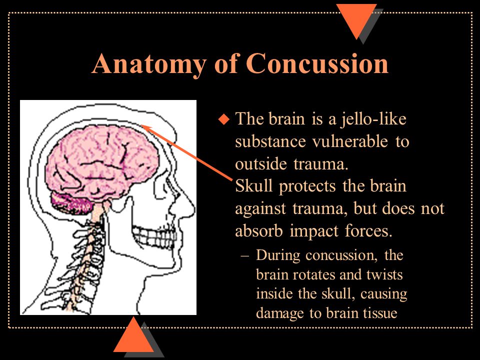 Anatomy of Concussion u The brain is a jello-like substance vulnerable to outside trauma.