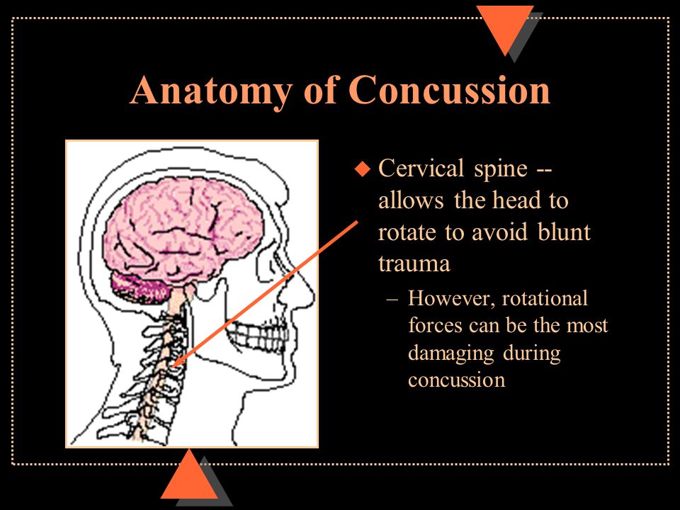 Anatomy of Concussion u Cervical spine -- allows the head to rotate to avoid blunt trauma –However, rotational forces can be the most damaging during concussion
