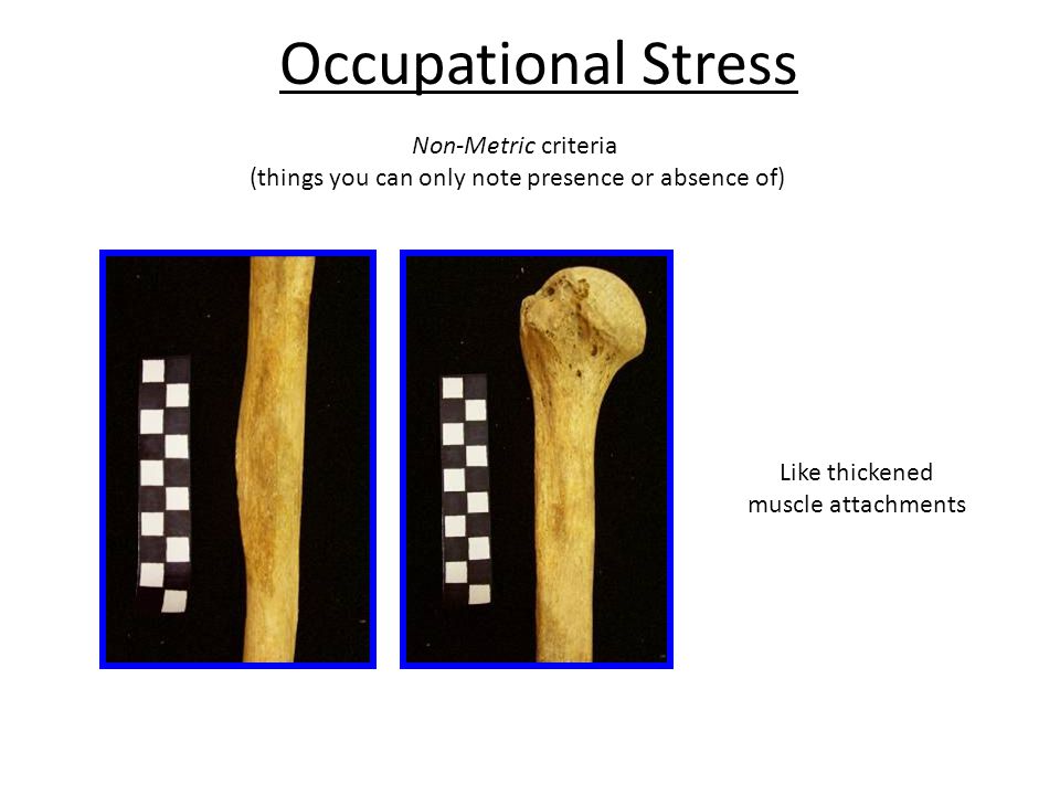 Occupational Stress Non-Metric criteria (things you can only note presence or absence of) Like thickened muscle attachments