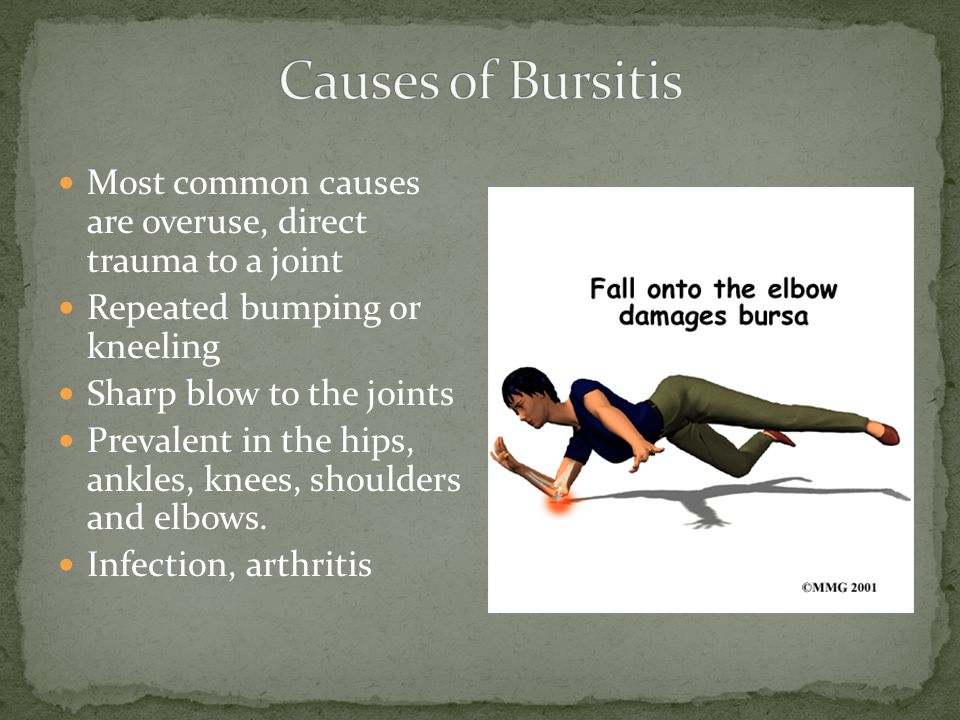 Most common causes are overuse, direct trauma to a joint Repeated bumping or kneeling Sharp blow to the joints Prevalent in the hips, ankles, knees, shoulders and elbows.