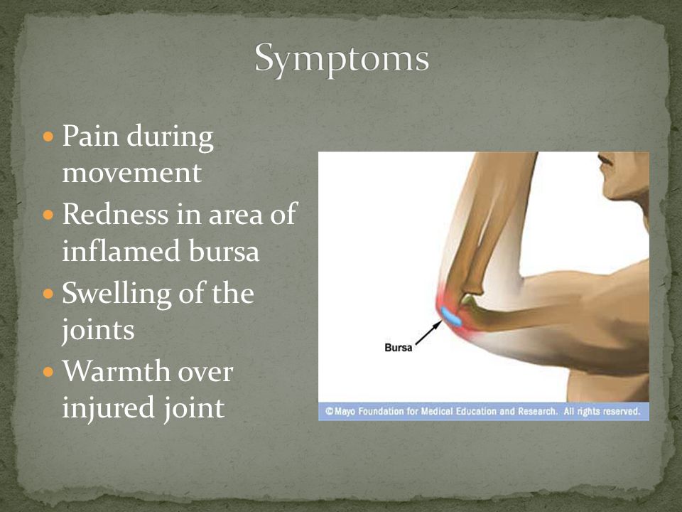 Pain during movement Redness in area of inflamed bursa Swelling of the joints Warmth over injured joint