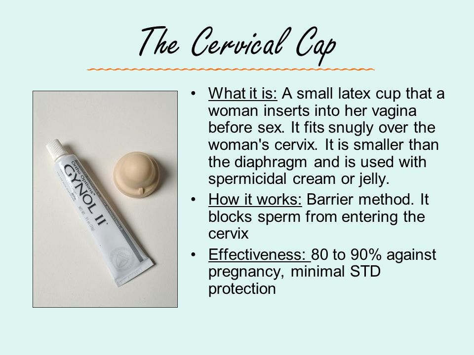 The Cervical Cap What it is: A small latex cup that a woman inserts into her vagina before sex.
