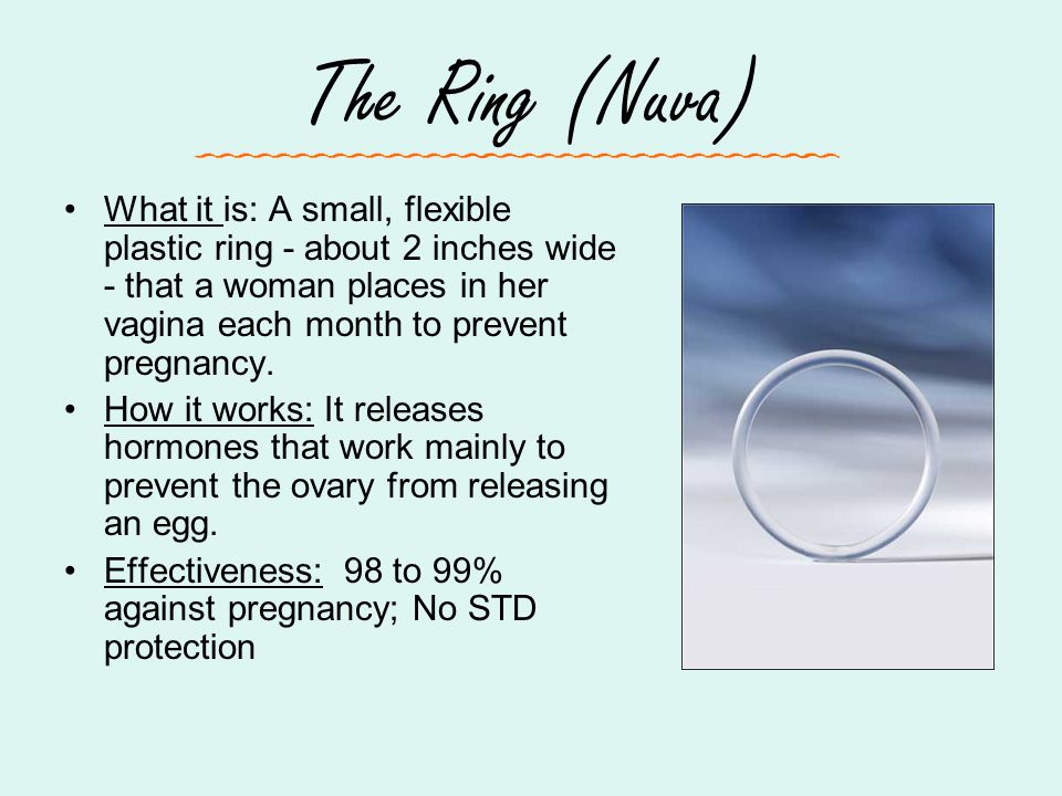 The Ring (Nuva) What it is: A small, flexible plastic ring - about 2 inches wide - that a woman places in her vagina each month to prevent pregnancy.