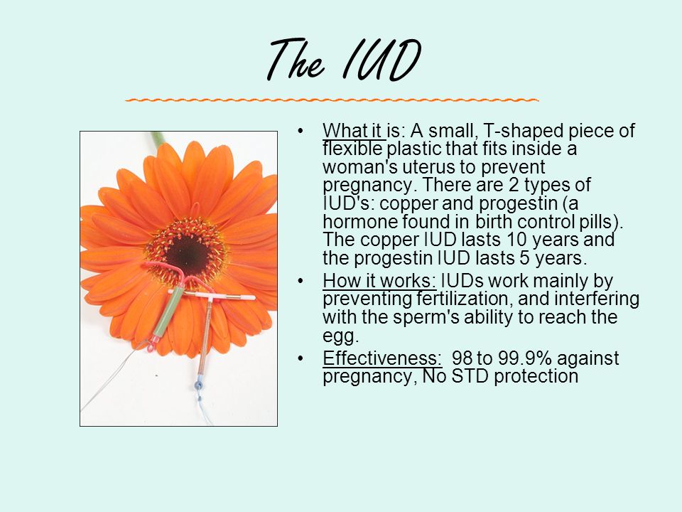 The IUD What it is: A small, T-shaped piece of flexible plastic that fits inside a woman s uterus to prevent pregnancy.