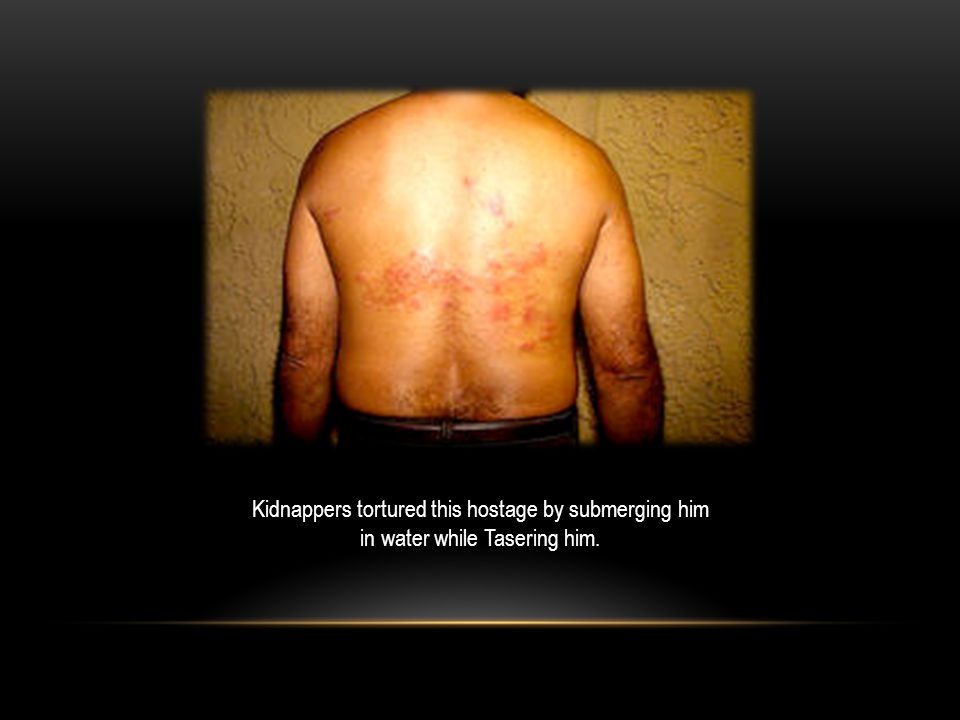 Kidnappers tortured this hostage by submerging him in water while Tasering him.