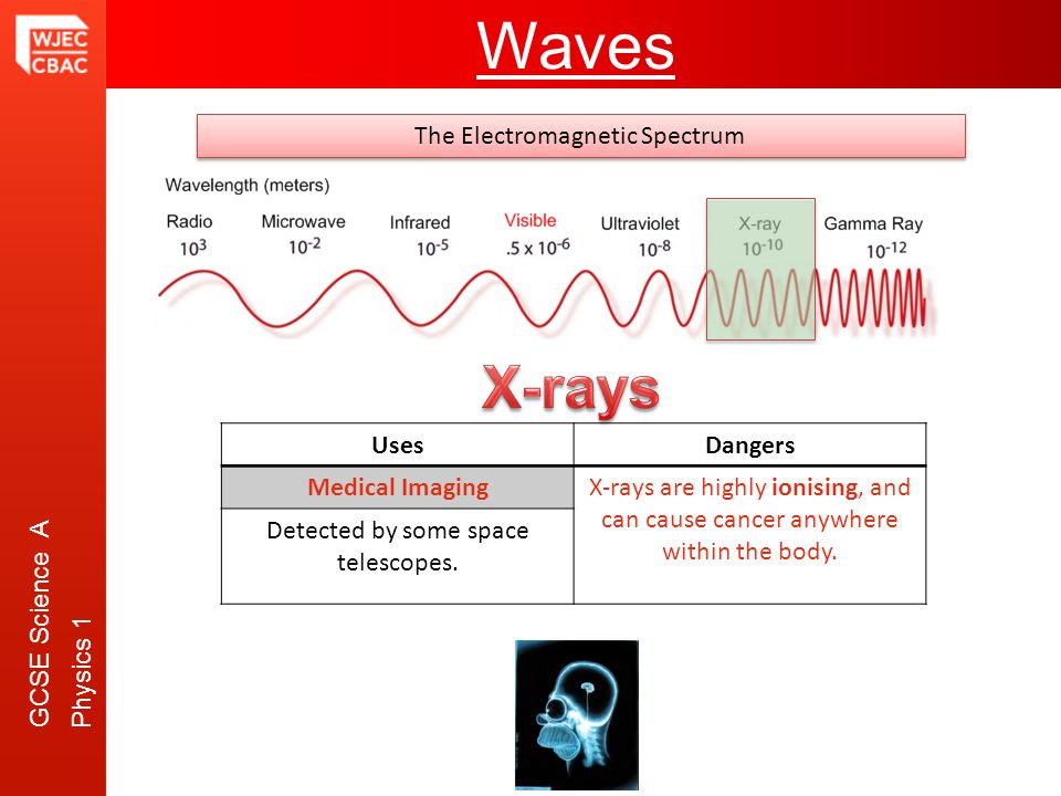 GCSE Science A Physics 1 Waves The Electromagnetic Spectrum UsesDangers Medical ImagingX-rays are highly ionising, and can cause cancer anywhere within the body.