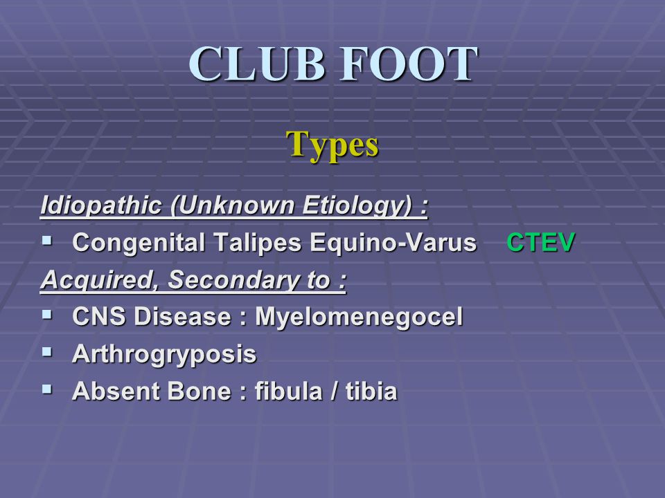 Congenital Talipes Equino Varus Congenital Clubfoot Dr Mazloumi Md Associate Professor Pediatric Orthopedic Surgeon Ppt Download