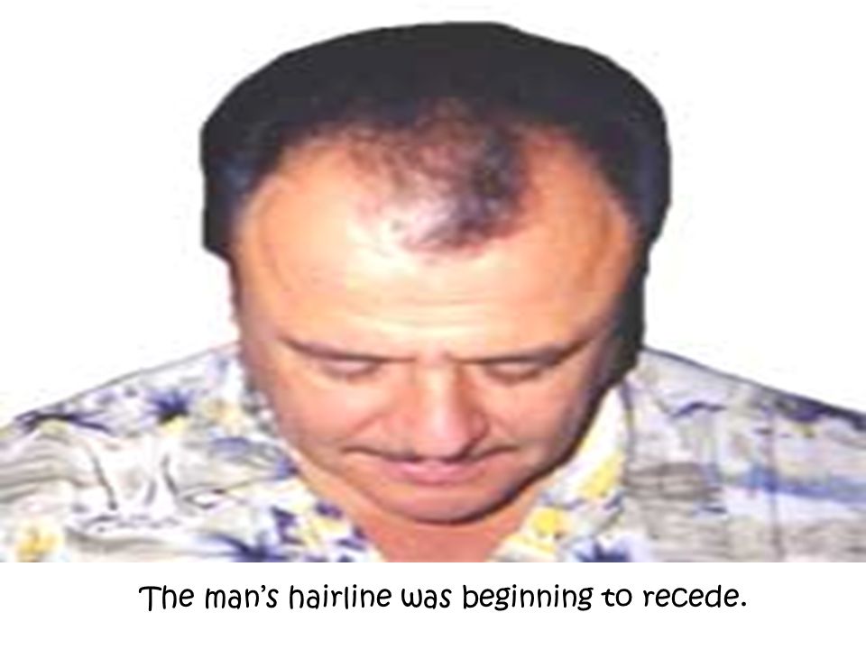The man’s hairline was beginning to recede.