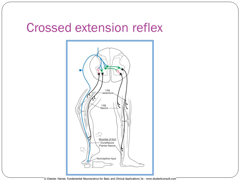 Crossed extension reflex