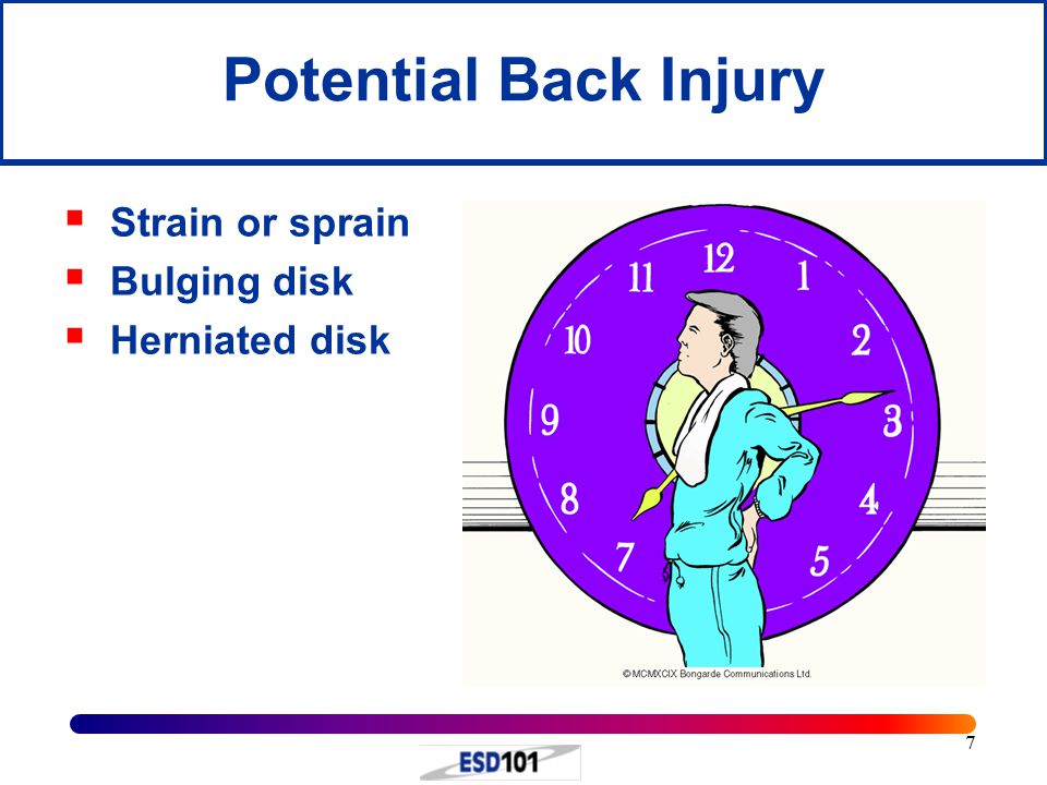 7 Potential Back Injury  Strain or sprain  Bulging disk  Herniated disk