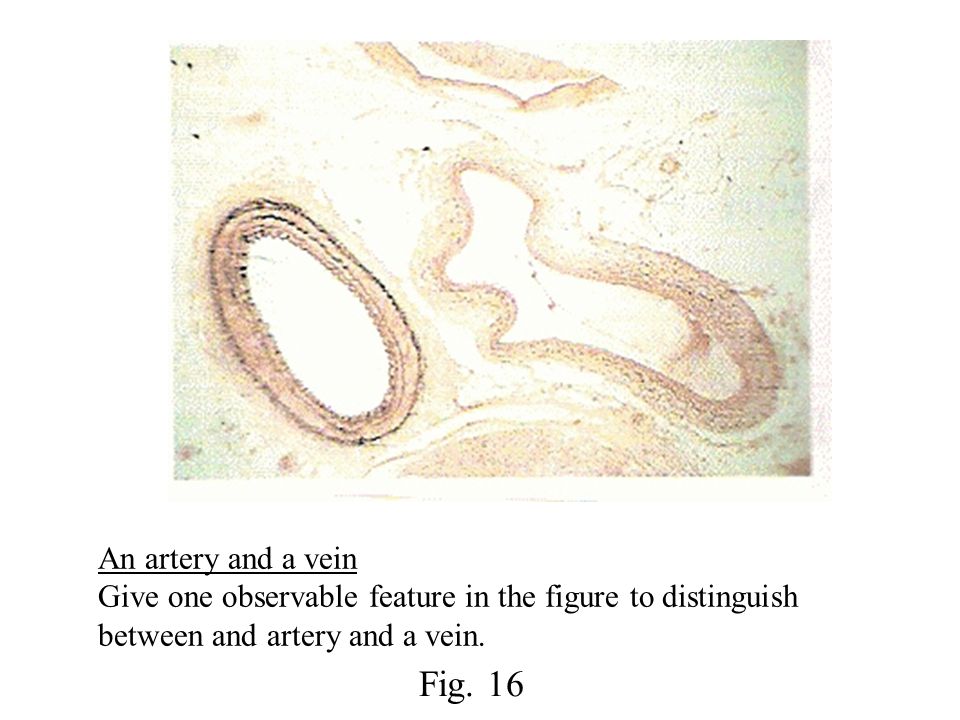 An artery and a vein Give one observable feature in the figure to distinguish between and artery and a vein.