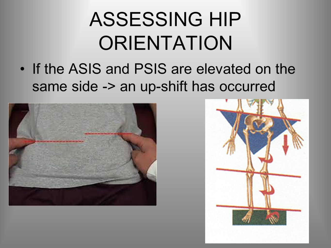 ASSESSING HIP ORIENTATION If the ASIS and PSIS are elevated on the same side -> an up-shift has occurred