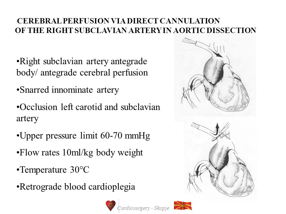 cardiosurgery skopje surgery for