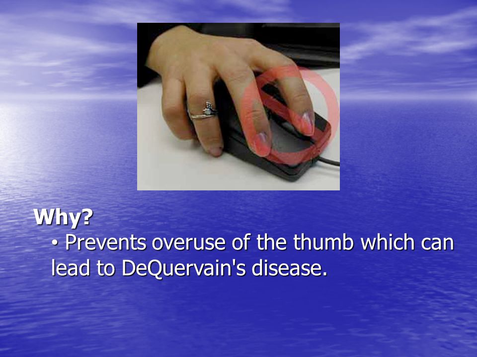 Why Prevents overuse of the thumb which can lead to DeQuervain s disease.
