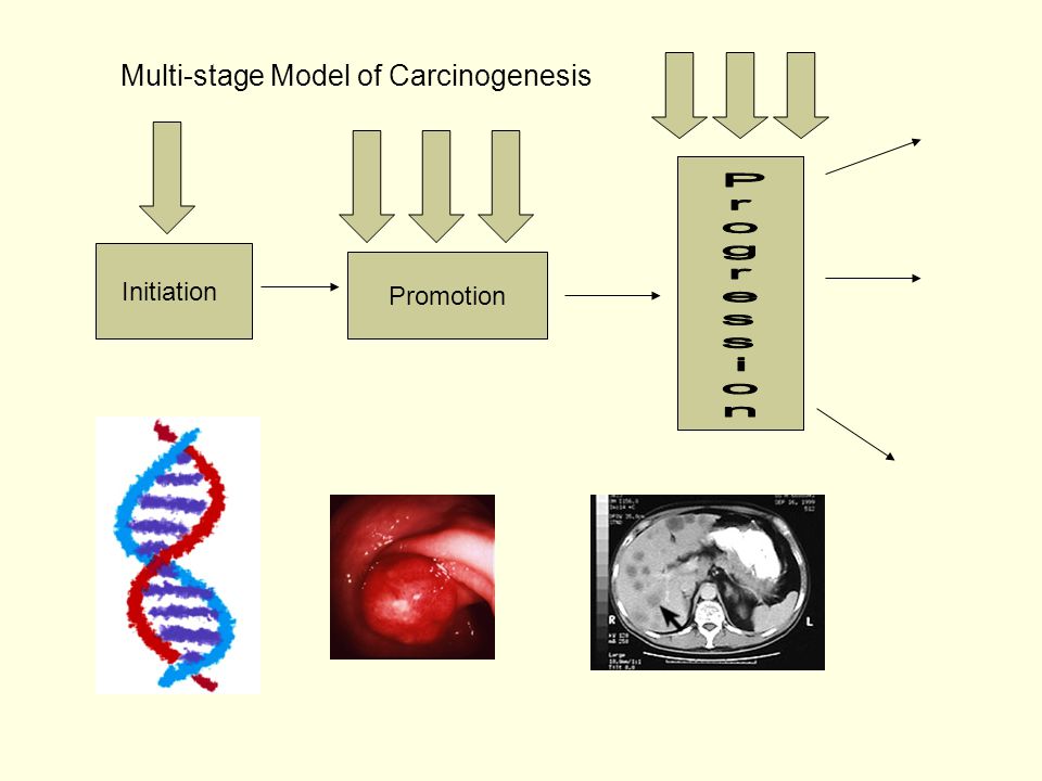 Initiation Promotion Multi-stage Model of Carcinogenesis