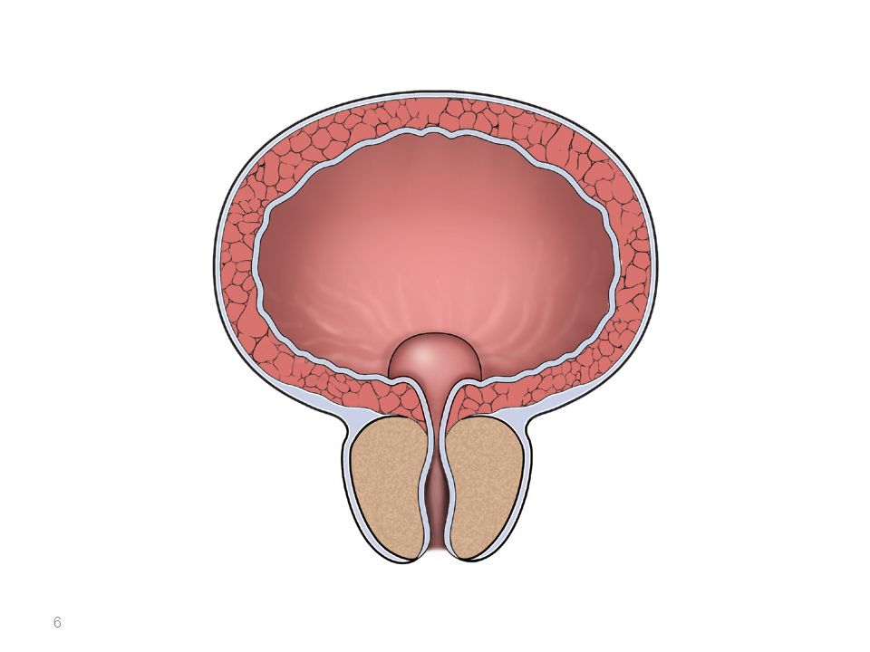 Простата развивается. Простата. Аденома. Мочевой пузырь..
