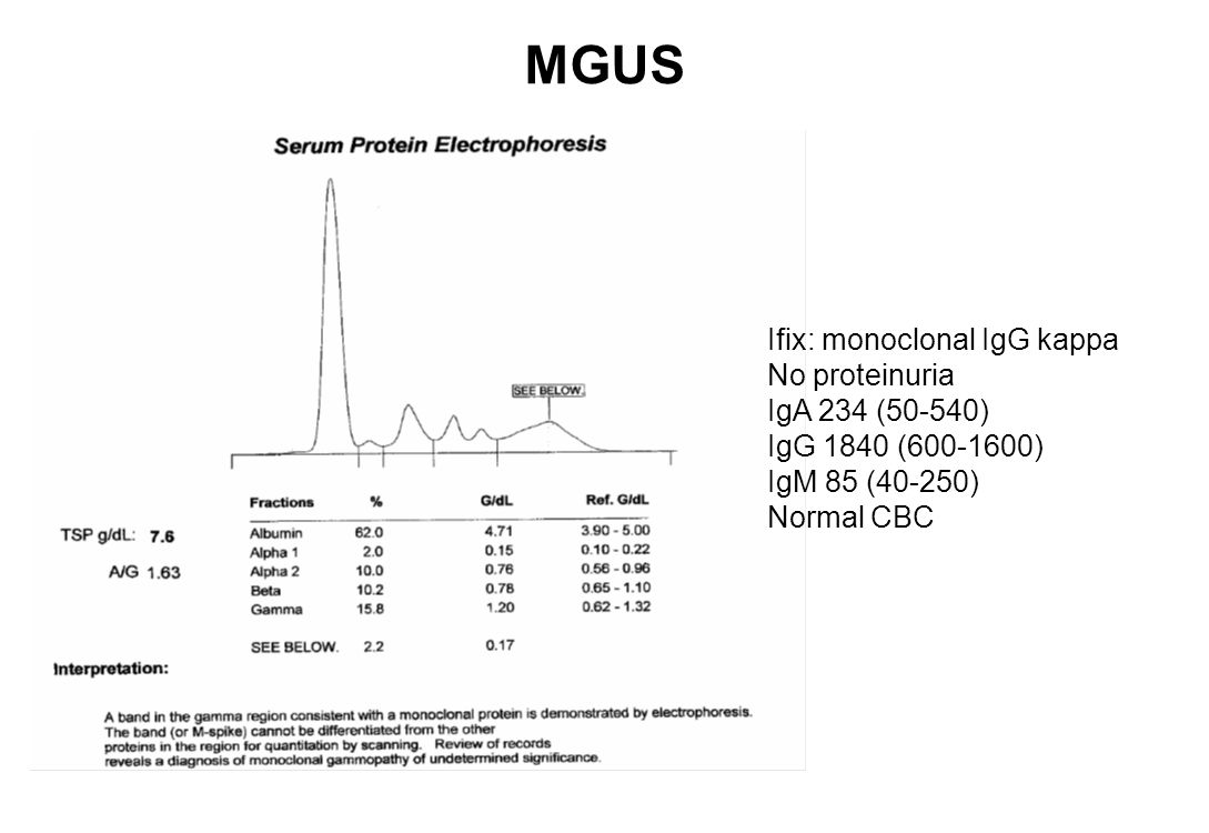 PLASMA CELL DYSCRASIAS Monoclonal gammopathy of uncertain significance (MGUS)   Idiopathic  Associated with other diseases (autoimmune, infectious,  non-heme. - ppt download