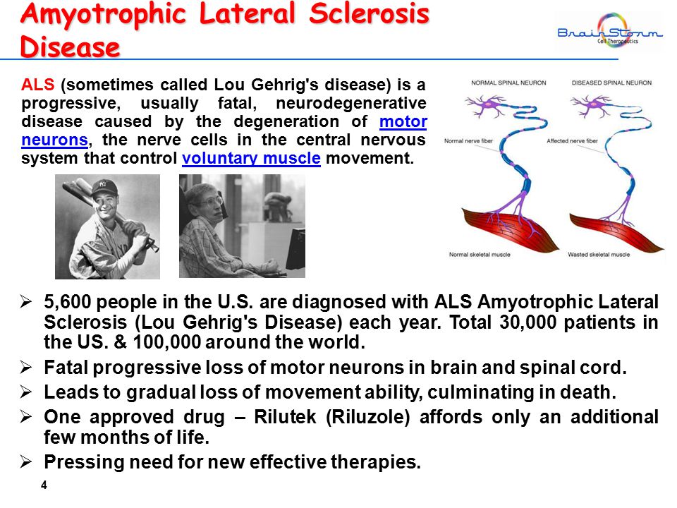 4 Amyotrophic Lateral Sclerosis Disease  5,600 people in the U.S.