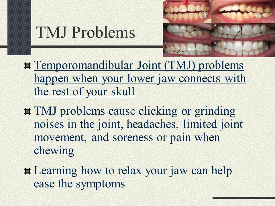 TMJ Problems Temporomandibular Joint (TMJ) problems happen when your lower jaw connects with the rest of your skull TMJ problems cause clicking or grinding noises in the joint, headaches, limited joint movement, and soreness or pain when chewing Learning how to relax your jaw can help ease the symptoms