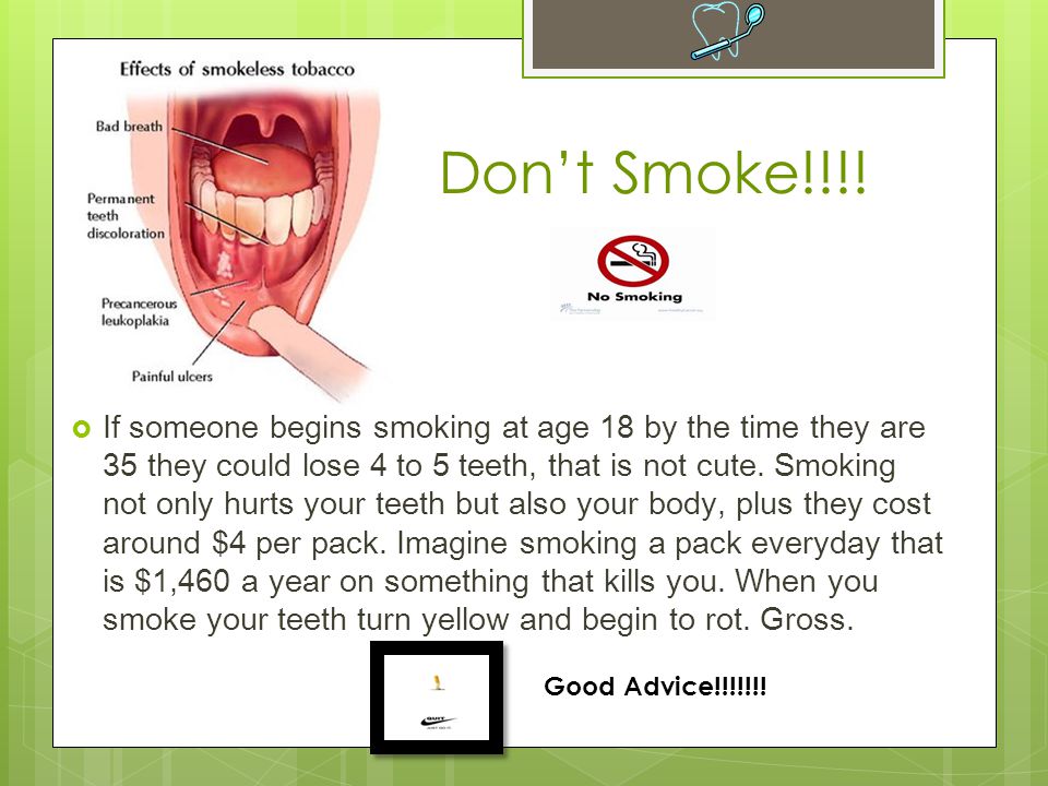  If someone begins smoking at age 18 by the time they are 35 they could lose 4 to 5 teeth, that is not cute.