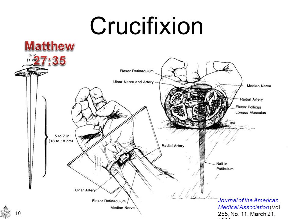 Crucifixion Journal of the American Medical AssociationJournal of the American Medical Association (Vol.
