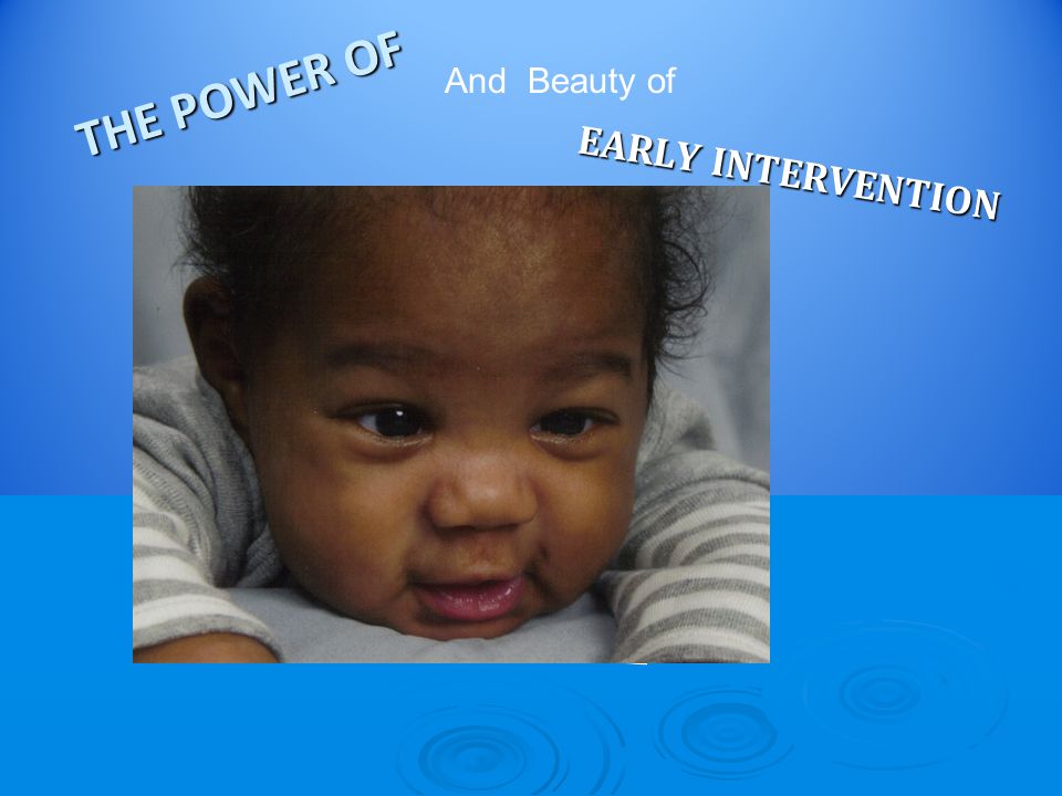 THE POWER OF EARLY INTERVENTION And Beauty of