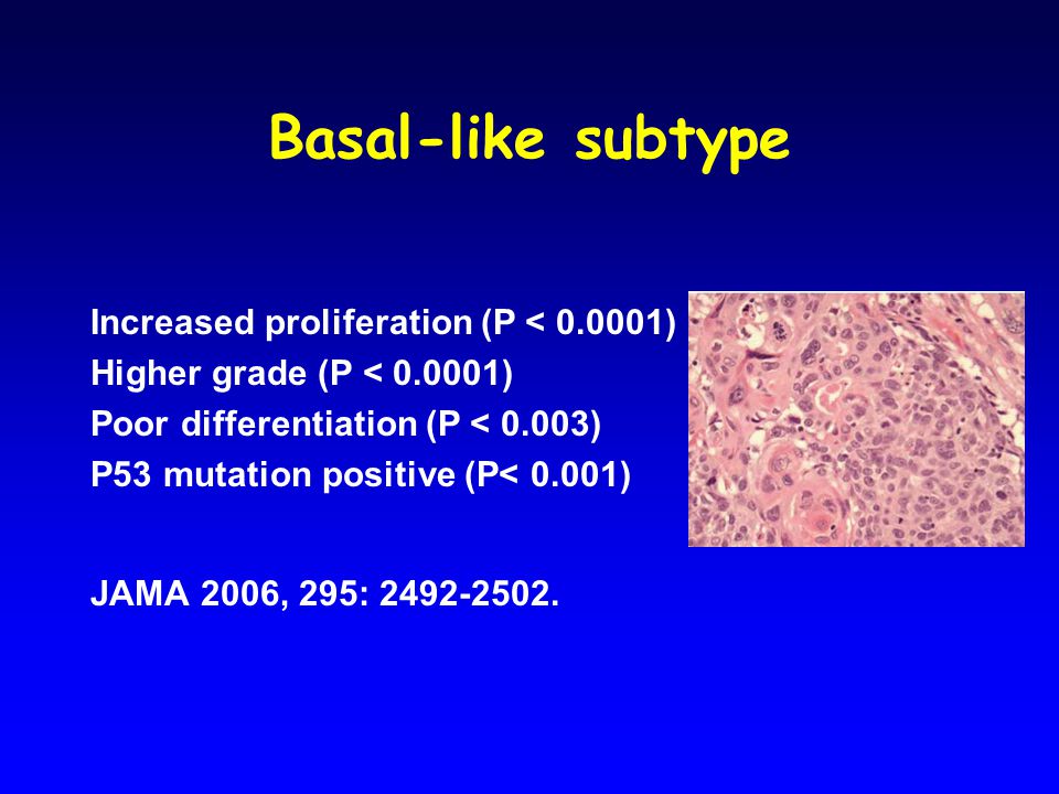 Basal-like subtype Increased proliferation (P < ) Higher grade (P < ) Poor differentiation (P < 0.003) P53 mutation positive (P< 0.001) JAMA 2006, 295: