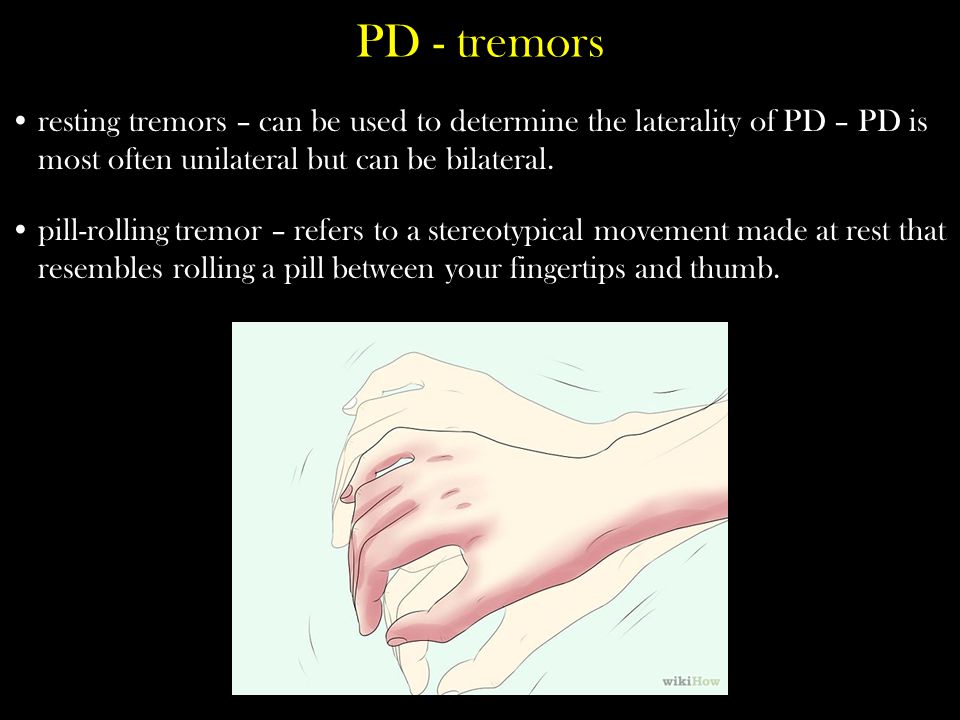 Motor Control and Disorders. Basal Ganglia Disorders Parkinson's Disease  Huntington's Disease Tourette's Syndrome. - ppt download