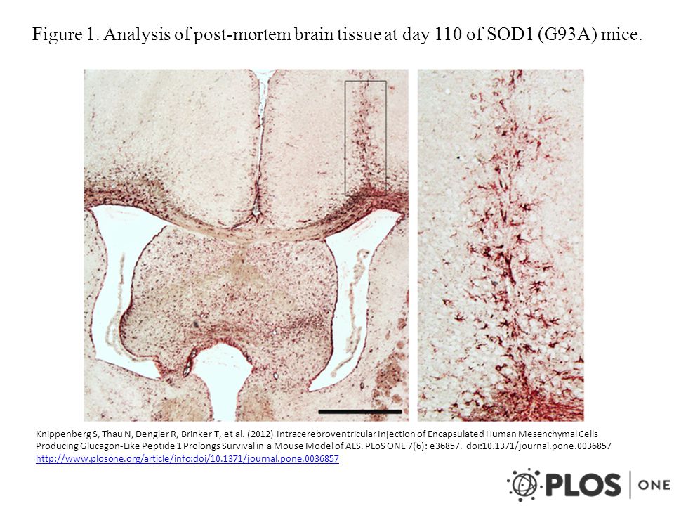 Figure 1. Analysis of post-mortem brain tissue at day 110 of SOD1 (G93A) mice.